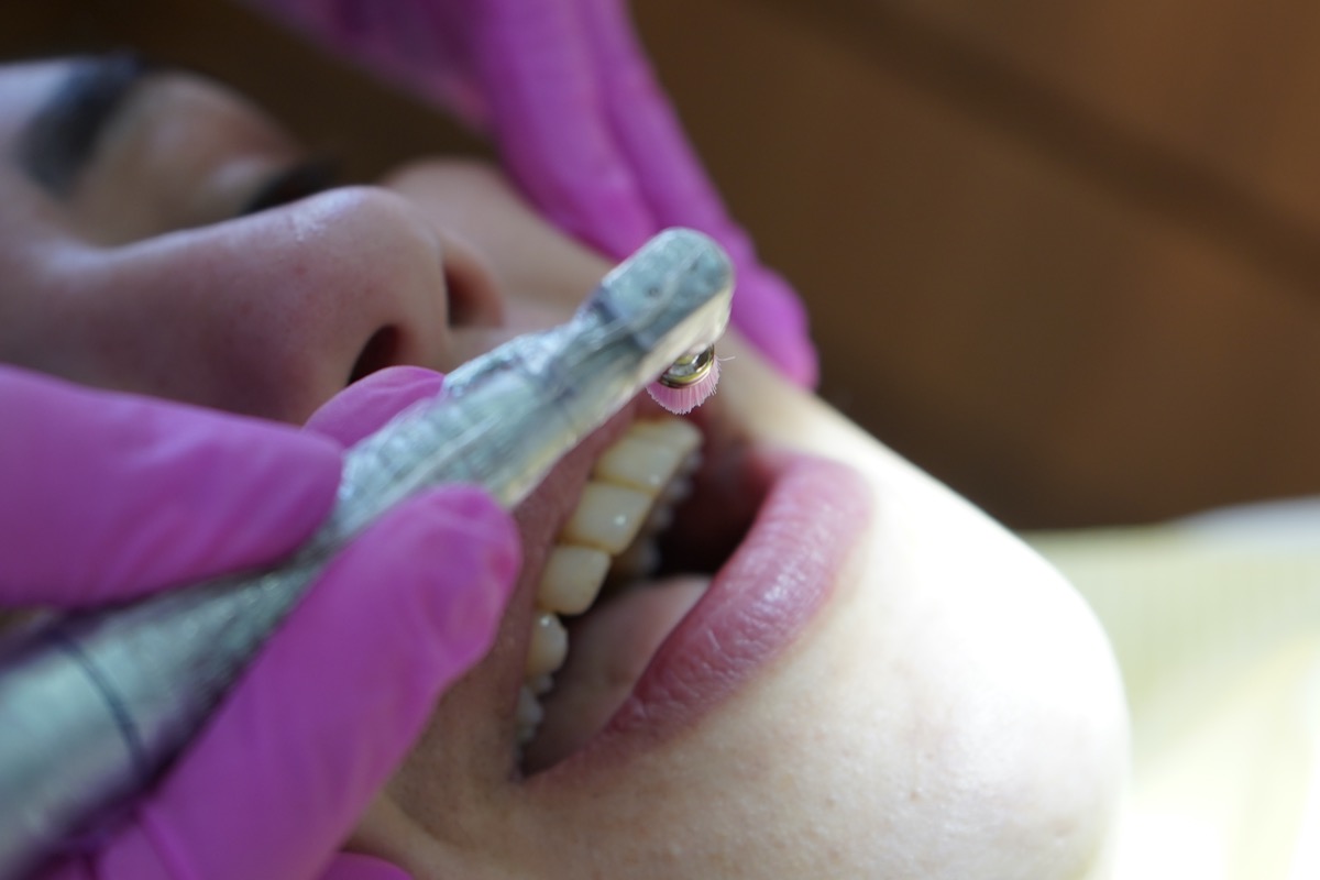 Limpeza dental e prevenção